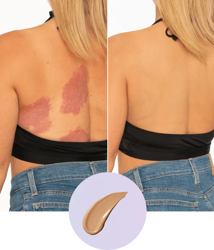 Body Coverage Perfector SPF 30 – Body Makeup for the Face, Arms & Body